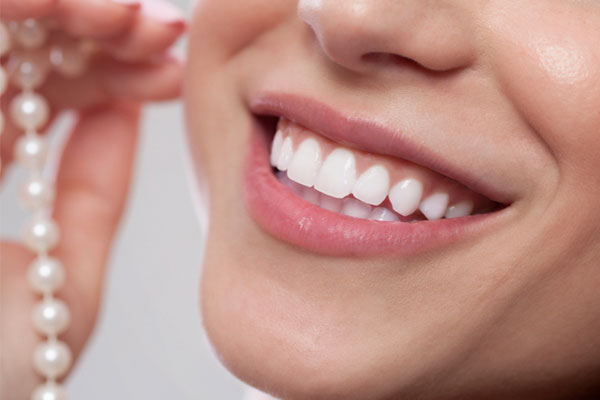 Porcelain (Emax) Veneers